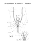 DEVICE FOR OPENING AND CLOSING A ZIPPER diagram and image