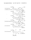 Detailfunction Based Measurement diagram and image