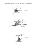 Instrument Attached Cappers diagram and image