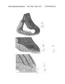 PATIENT INTERFACE STRUCTURE AND METHOD/TOOL FOR MANUFACTURING SAME diagram and image