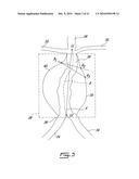  METHOD FOR TRACKING 3D ANATOMICAL AND PATHOLOGICAL CHANGES IN TUBULAR-SHAPED ANATOMICAL STRUCTURES diagram and image