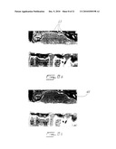  METHOD FOR TRACKING 3D ANATOMICAL AND PATHOLOGICAL CHANGES IN TUBULAR-SHAPED ANATOMICAL STRUCTURES diagram and image