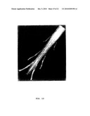  METHOD FOR TRACKING 3D ANATOMICAL AND PATHOLOGICAL CHANGES IN TUBULAR-SHAPED ANATOMICAL STRUCTURES diagram and image