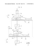 METHOD OF CT PERFUSION IMAGING AND APPARATUS FOR IMPLEMENTING SAME diagram and image