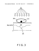 X-RAY INSPECTION DEVICE diagram and image