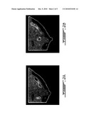 REGISTRATION OF OPTICAL IMAGES OF TURBID MEDIA diagram and image