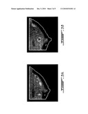 REGISTRATION OF OPTICAL IMAGES OF TURBID MEDIA diagram and image