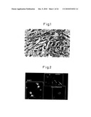 Method of inducing differentiation of bone marrow stromal cells to neural cells or skeletal muscle cells by introduction of notch gene diagram and image