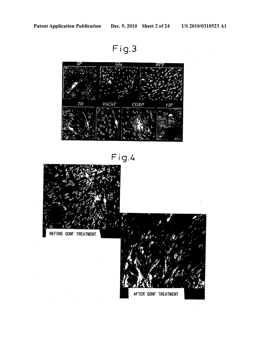 Method of inducing differentiation of bone marrow stromal cells to neural cells or skeletal muscle cells by introduction of notch gene - diagram, schematic, and image 03