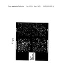 Method of inducing differentiation of bone marrow stromal cells to neural cells or skeletal muscle cells by introduction of notch gene diagram and image