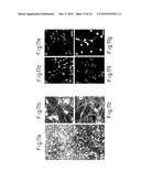 Method of inducing differentiation of bone marrow stromal cells to neural cells or skeletal muscle cells by introduction of notch gene diagram and image