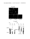 Method of inducing differentiation of bone marrow stromal cells to neural cells or skeletal muscle cells by introduction of notch gene diagram and image