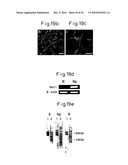 Method of inducing differentiation of bone marrow stromal cells to neural cells or skeletal muscle cells by introduction of notch gene diagram and image