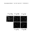 Method of inducing differentiation of bone marrow stromal cells to neural cells or skeletal muscle cells by introduction of notch gene diagram and image