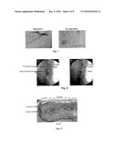 Compositions Suitable for Treatment of Spinal Disease, Disorder or Condition diagram and image