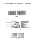 Compositions Suitable for Treatment of Spinal Disease, Disorder or Condition diagram and image