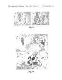 Compositions Suitable for Treatment of Spinal Disease, Disorder or Condition diagram and image