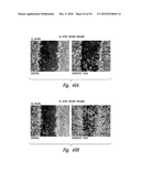 COMPOSITIONS AND METHODS FOR TREATING INSULIN RESISTANCE AND DIABETES MELLITUS diagram and image