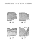 COMPOSITIONS AND METHODS FOR TREATING INSULIN RESISTANCE AND DIABETES MELLITUS diagram and image