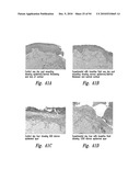 BACTERIOSTATIC OR BACTERIOCIDAL COMPOSITIONS AND METHODS diagram and image