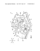 SELF-LIGATING ORTHODONTIC BRACKET diagram and image