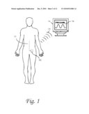 Systems and methods for lumbar cerebrospinal fluid access and treatment diagram and image