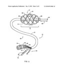 Chamber location method diagram and image