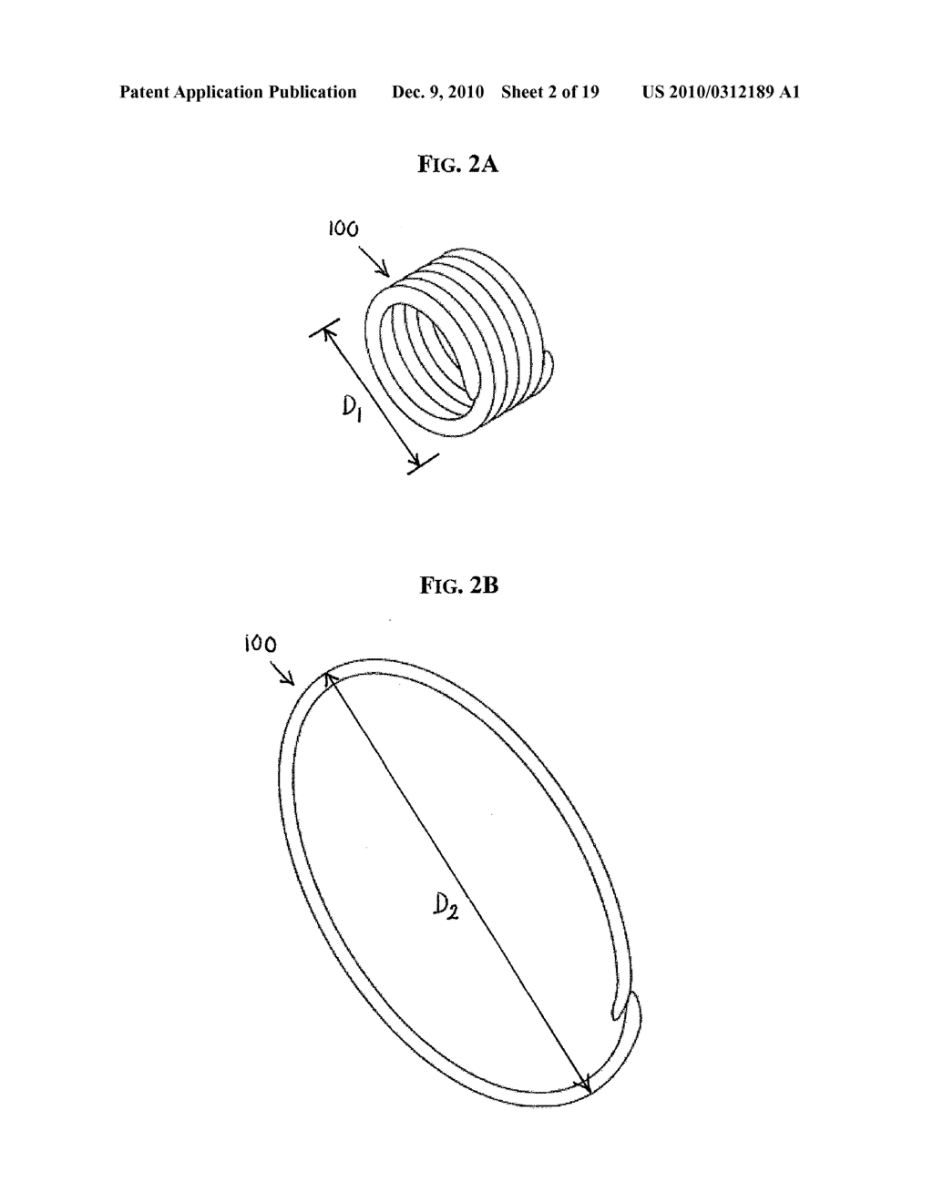 FLEXIBLE CANNULA DEVICES AND METHODS - diagram, schematic, and image 03