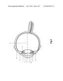 A METHOD AND A SYSTEM FOR LASER PHOTOABLATION WITHIN A LENS diagram and image