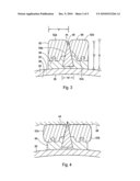 CUTTING BALLOON HAVING SHEATHED INCISING ELEMENTS diagram and image