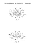 CUTTING BALLOON HAVING SHEATHED INCISING ELEMENTS diagram and image