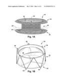 APPARATUS AND METHOD FOR REPLACING A DISEASED CARDIAC VALVE diagram and image