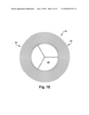 APPARATUS AND METHOD FOR REPLACING A DISEASED CARDIAC VALVE diagram and image