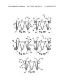 APPARATUS AND METHOD FOR REPLACING A DISEASED CARDIAC VALVE diagram and image