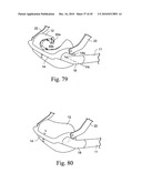 RESPIRATORY MASK diagram and image