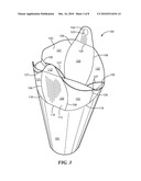 Vessel and Method for Making the Same diagram and image