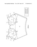 Vessel and Method for Making the Same diagram and image