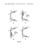 IMPLANT MASK WITH MOVEABLE MASK SEGMENTS diagram and image