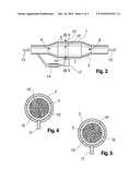 EXHAUST GAS-TREATING DEVICE diagram and image