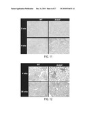 Immunogenic compositions against tuberculosis diagram and image