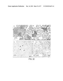 Immunogenic compositions against tuberculosis diagram and image