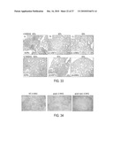 Immunogenic compositions against tuberculosis diagram and image