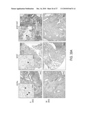 Immunogenic compositions against tuberculosis diagram and image