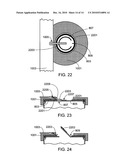 Integrated battery pressure relief and terminal isolation system diagram and image