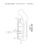 METHOD OF MAKING A SURGICAL TEMPLATE USED FOR A COMPUTER-GUIDED DENTAL IMPLANT SURGERY diagram and image