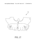 METHOD OF MAKING A SURGICAL TEMPLATE USED FOR A COMPUTER-GUIDED DENTAL IMPLANT SURGERY diagram and image