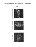METHOD FOR SCREENING AN INHIBITORY AGENT OF HBV PROLIFERATION BY USING THE INTERACTION BETWEEN HBV CAPSID AND SURFACE PROTEINS BASED ON CELLULAR IMAGING diagram and image