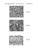 Nasopharyngeal cancer malignancy biomarker and method thereof diagram and image