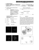 METHODS AND KITS FOR DIAGNOSING LUNG CANCER diagram and image