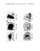 METHODS AND KITS FOR DIAGNOSING LUNG CANCER diagram and image